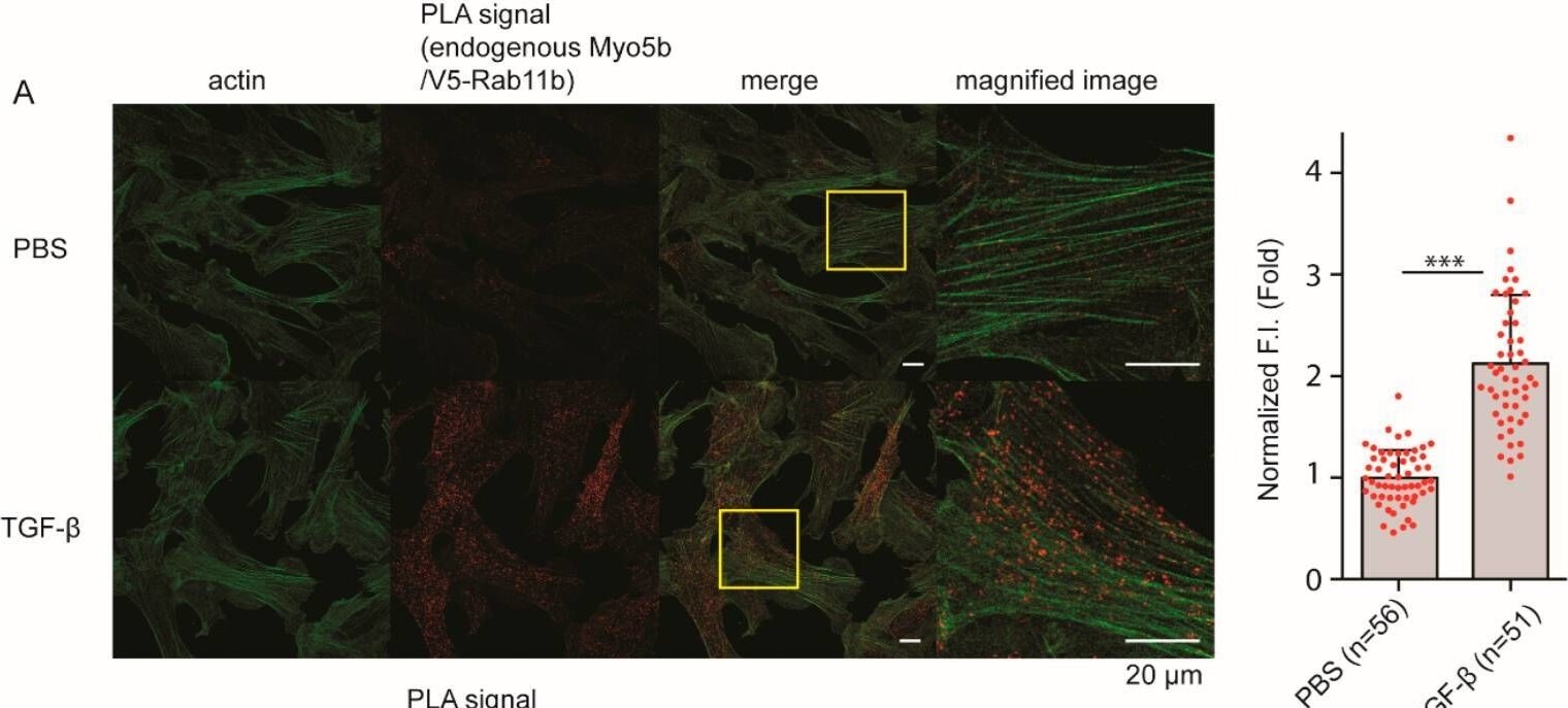 Myosin VB Antibody - BSA Free