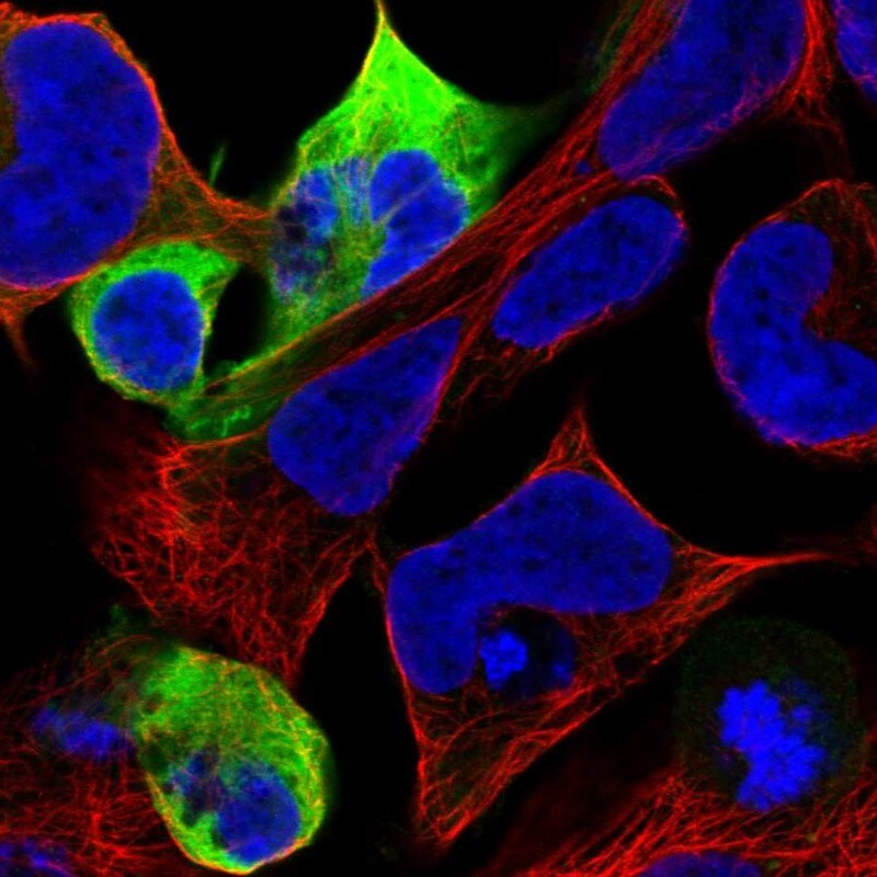 NF-M Antibody - BSA Free Immunocytochemistry/ Immunofluorescence: NF-M Antibody [NBP1-87753]