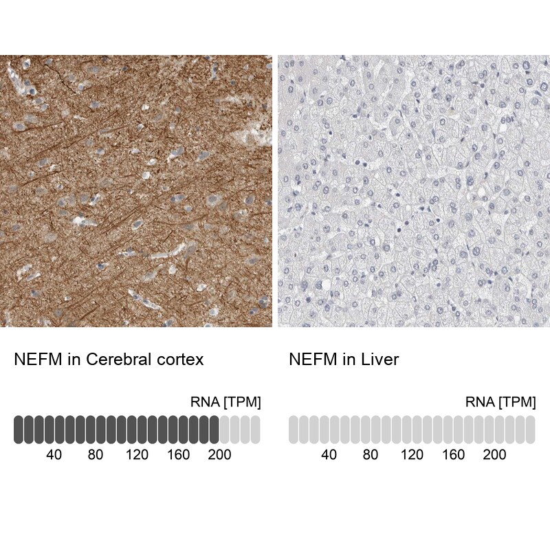NF-M Antibody - BSA Free Immunohistochemistry-Paraffin: NF-M Antibody [NBP1-87754]