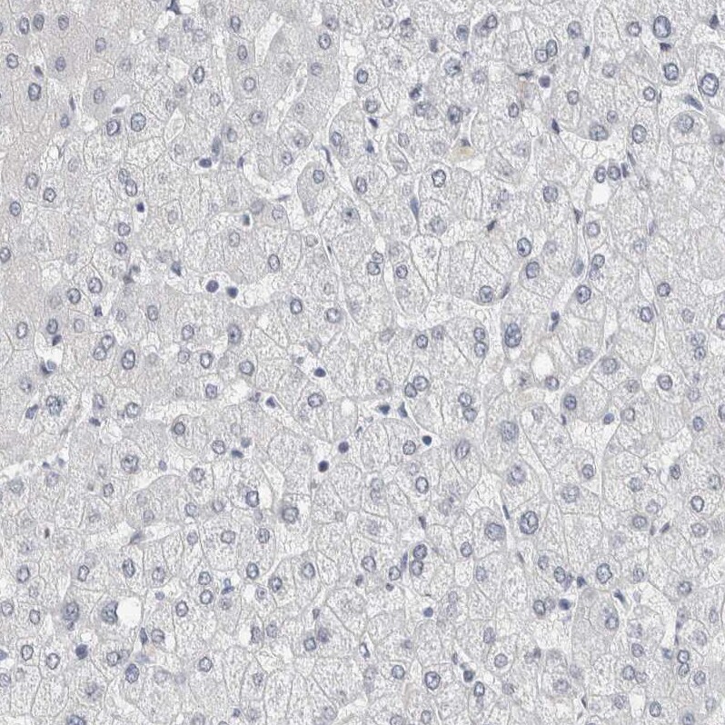 NF-M Antibody - BSA Free Immunohistochemistry-Paraffin: NF-M Antibody [NBP1-87754]
