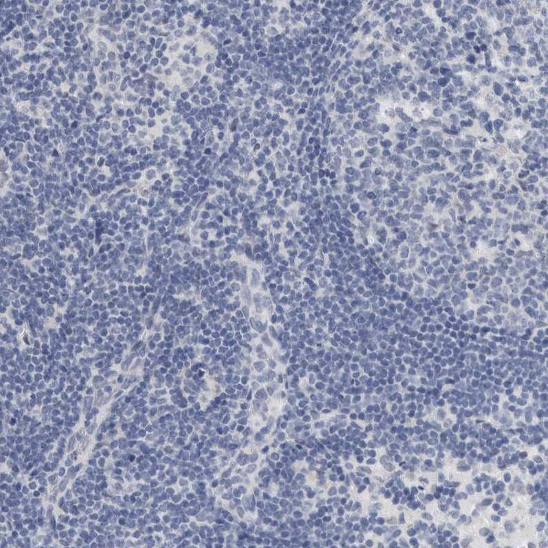 NF-M Antibody - BSA Free Immunohistochemistry-Paraffin: NF-M Antibody [NBP1-87754]