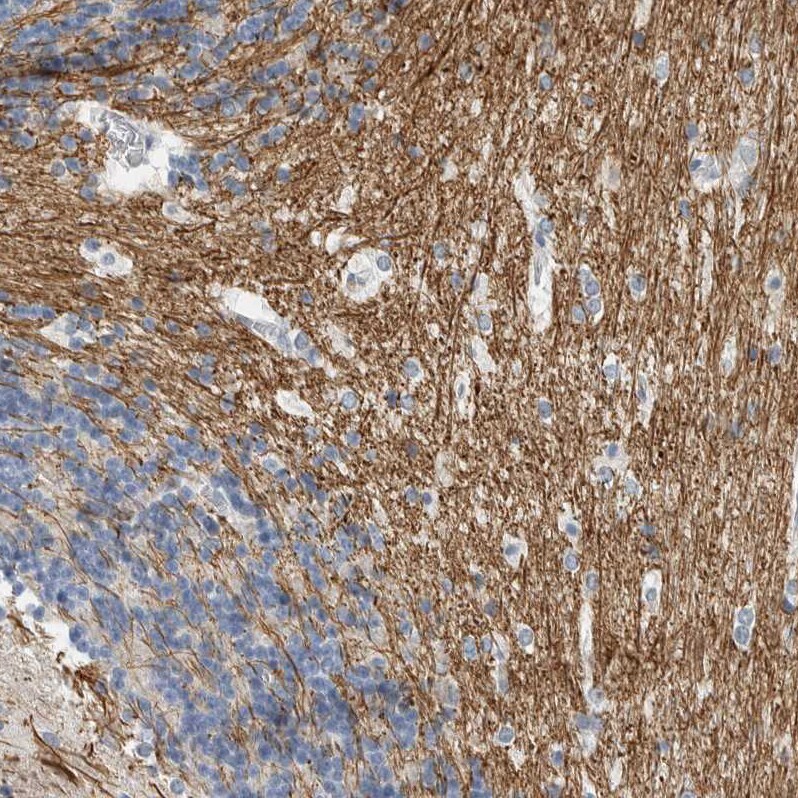 NF-M Antibody - BSA Free Immunohistochemistry-Paraffin: NF-M Antibody [NBP1-87754]