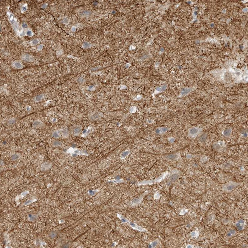 NF-M Antibody - BSA Free Immunohistochemistry-Paraffin: NF-M Antibody [NBP1-87754]