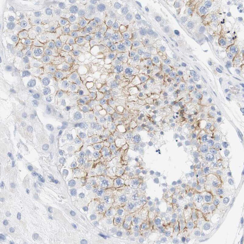 mu Opioid R/OPRM1 Antibody Immunohistochemistry-Paraffin: mu Opioid R/OPRM1 Antibody [NBP1-87767]
