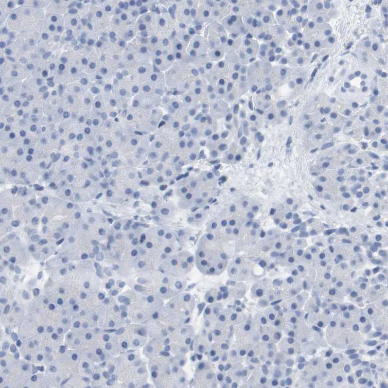 mu Opioid R/OPRM1 Antibody Immunohistochemistry-Paraffin: mu Opioid R/OPRM1 Antibody [NBP1-87767]