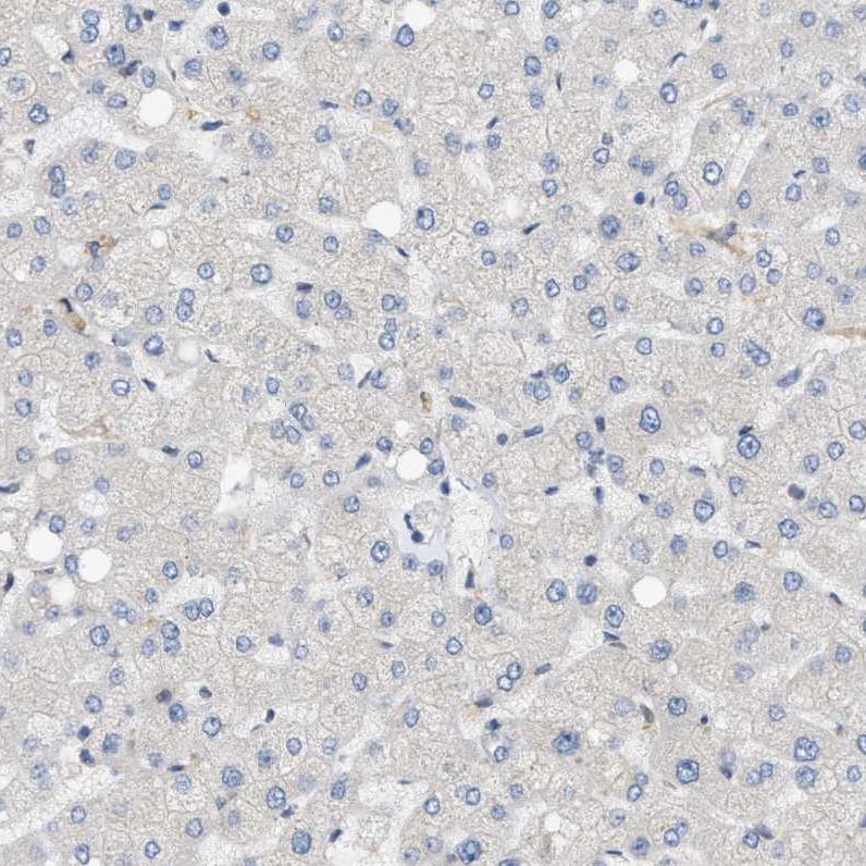 LIS1 Antibody - BSA Free Immunohistochemistry-Paraffin: LIS1 Antibody [NBP1-87769]