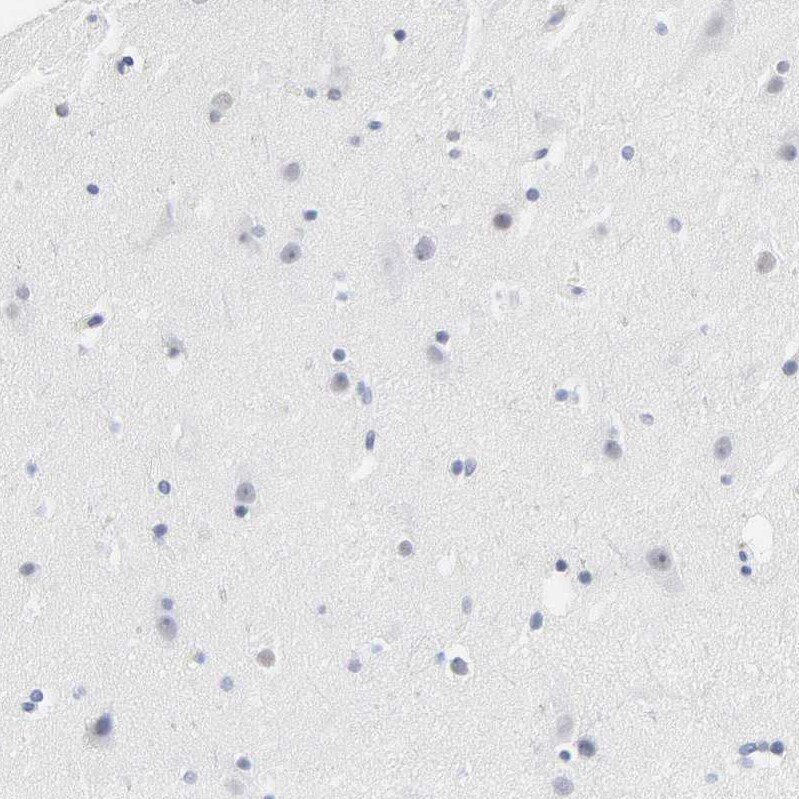 Serpin A4/Kallistatin Antibody - BSA Free Immunohistochemistry: Serpin A4/Kallistatin Antibody - BSA Free [NBP1-87777]