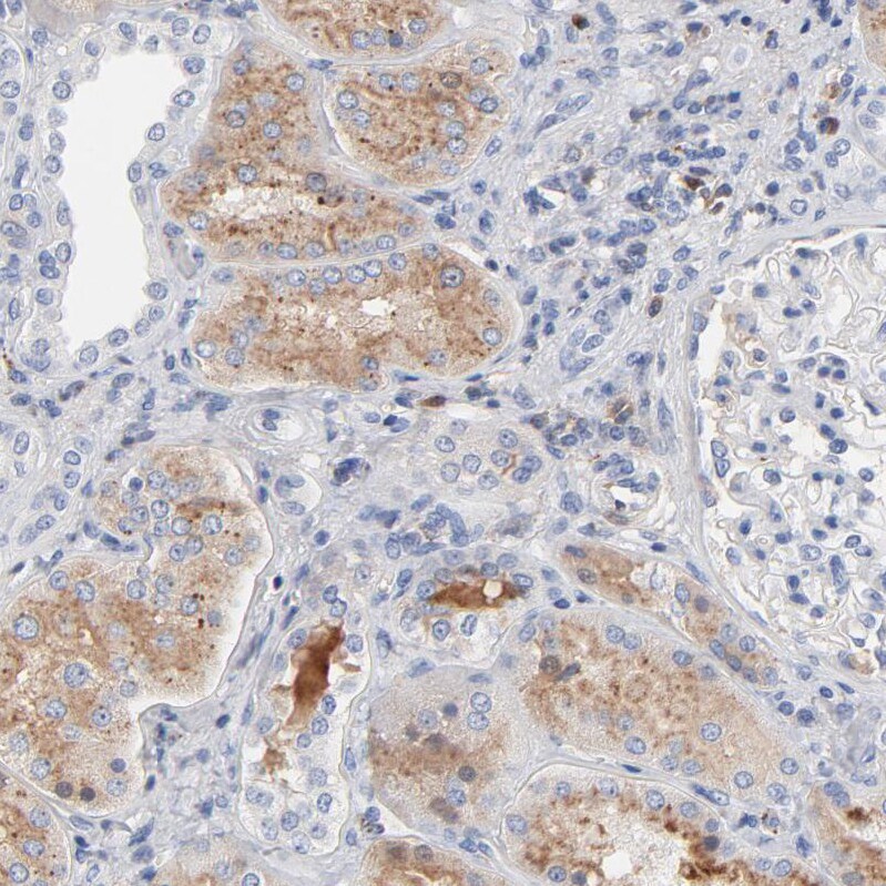 Serpin A4/Kallistatin Antibody - BSA Free Immunohistochemistry: Serpin A4/Kallistatin Antibody - BSA Free [NBP1-87777]