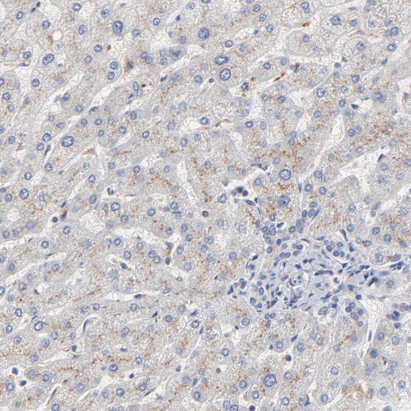 Serpin A4/Kallistatin Antibody - BSA Free Immunohistochemistry: Serpin A4/Kallistatin Antibody - BSA Free [NBP1-87777]