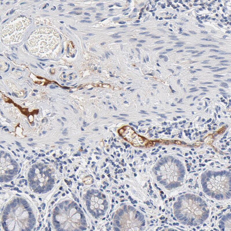 Serpin A4/Kallistatin Antibody - BSA Free Immunohistochemistry: Serpin A4/Kallistatin Antibody - BSA Free [NBP1-87777]