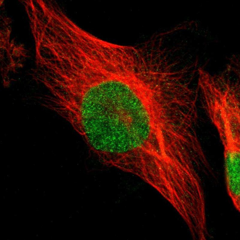 Tbp7 Antibody - BSA Free Immunocytochemistry/ Immunofluorescence: Tbp7 Antibody [NBP1-87799]