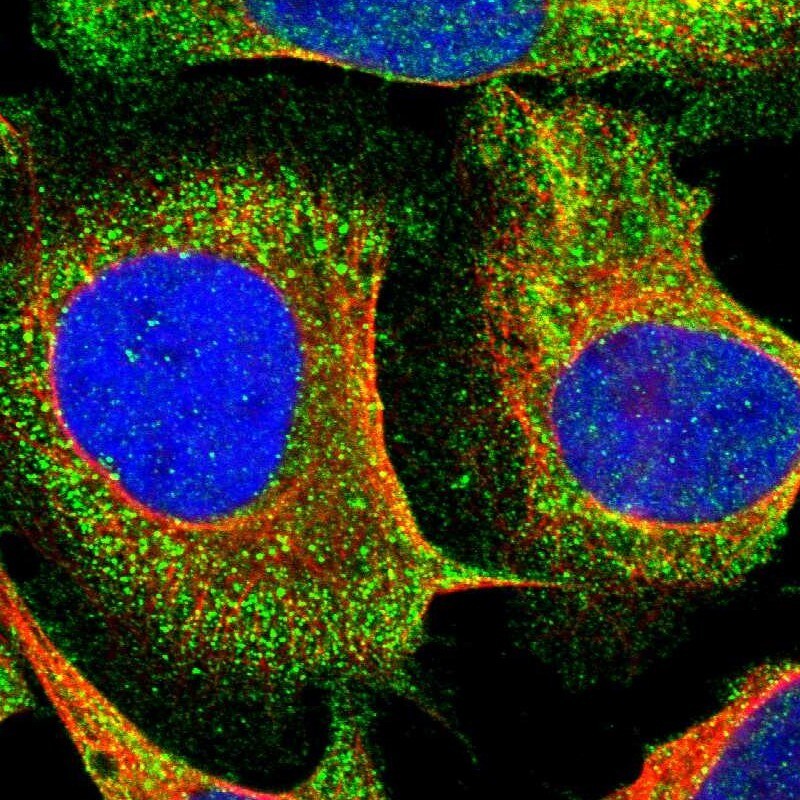 nSMase Antibody - BSA Free Immunocytochemistry/ Immunofluorescence: nSMase Antibody [NBP1-87810]