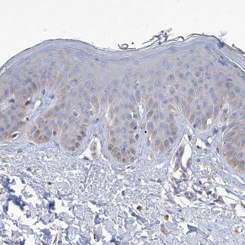 Spermine synthase Antibody - BSA Free Immunohistochemistry-Paraffin: Spermine synthase Antibody [NBP1-87812]