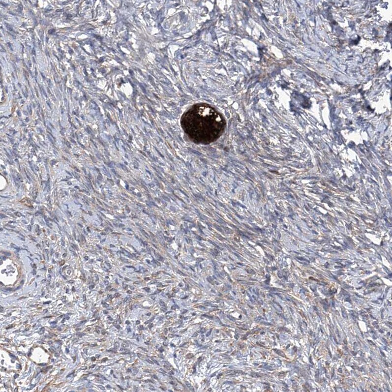 Spermine synthase Antibody - BSA Free Immunohistochemistry-Paraffin: Spermine synthase Antibody [NBP1-87812]