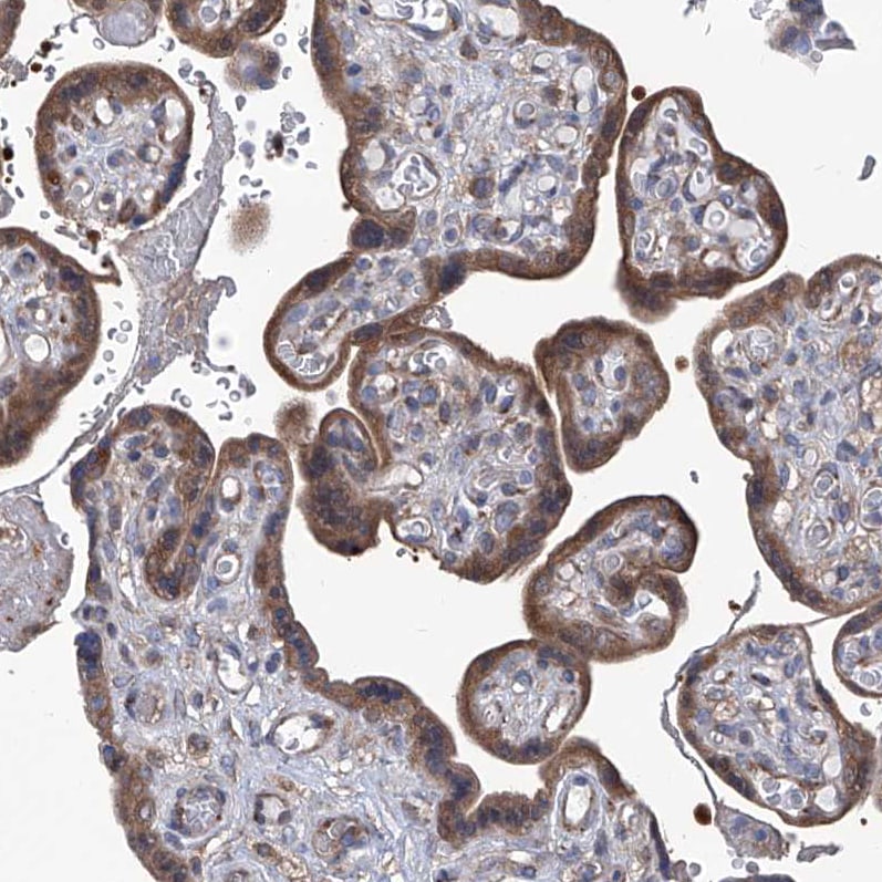 Spermine synthase Antibody - BSA Free Immunohistochemistry-Paraffin: Spermine synthase Antibody [NBP1-87812]