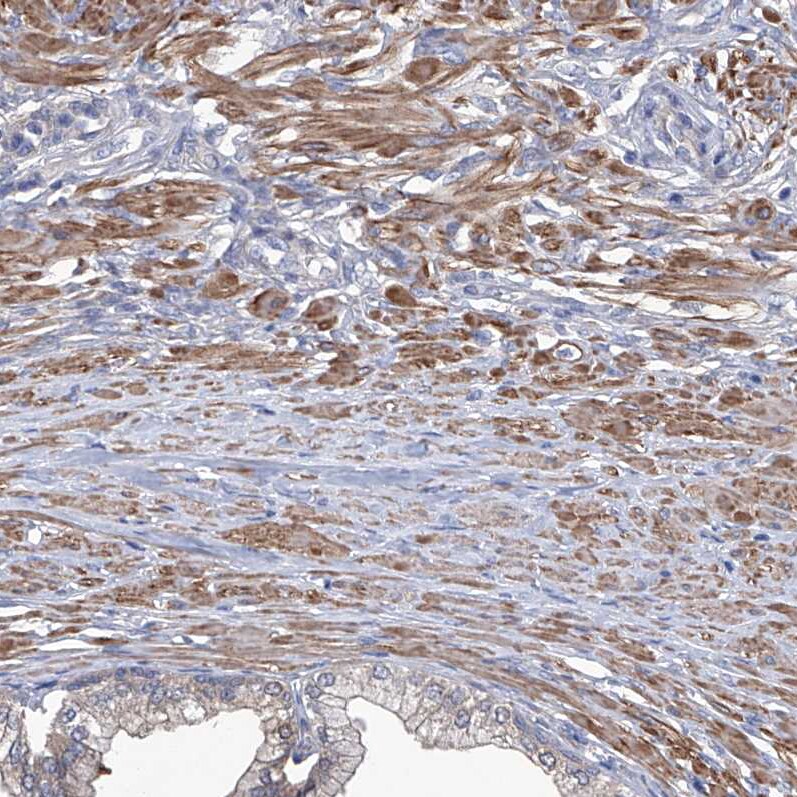 Spermine synthase Antibody - BSA Free Immunohistochemistry-Paraffin: Spermine synthase Antibody [NBP1-87812]