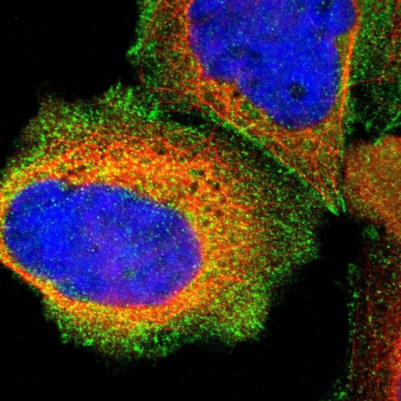 Talin1 Antibody - BSA Free Immunocytochemistry/ Immunofluorescence: Talin1 Antibody [NBP1-87820]