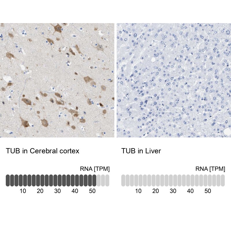 Tubby Antibody - BSA Free Immunohistochemistry-Paraffin: Tubby Antibody [NBP1-87824]