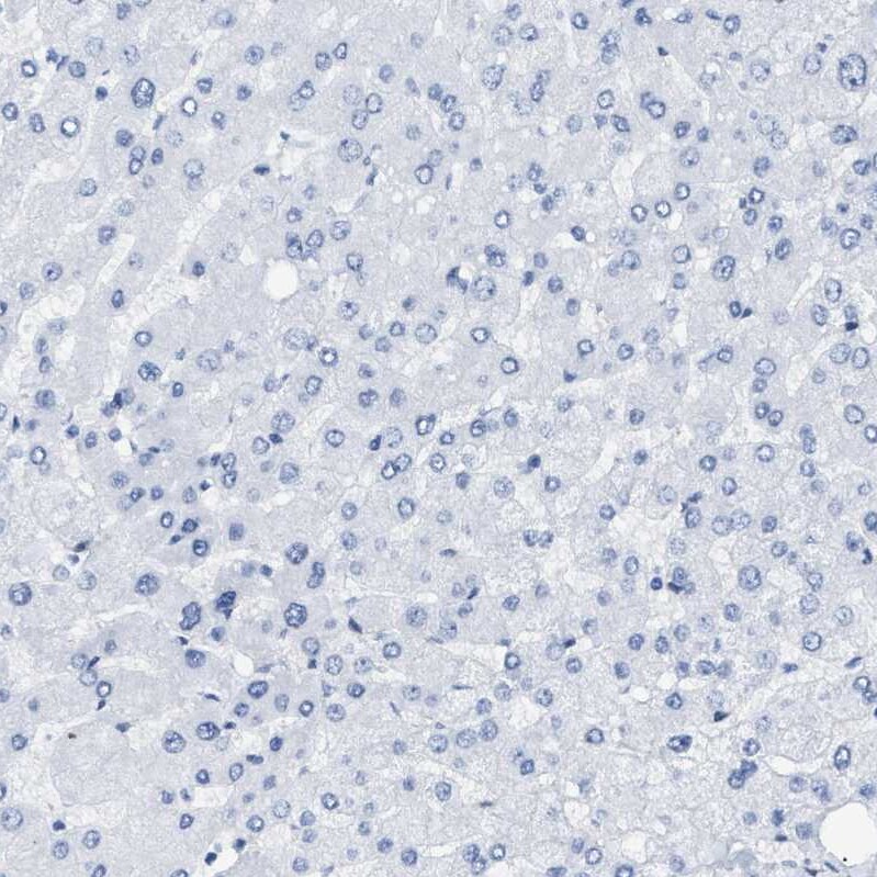 Tubby Antibody - BSA Free Immunohistochemistry-Paraffin: Tubby Antibody [NBP1-87824]