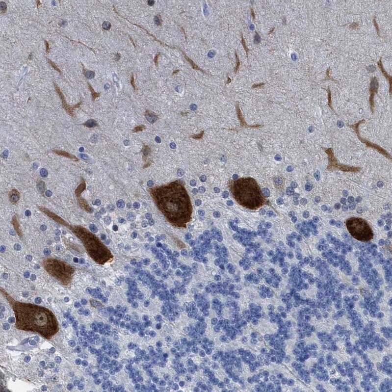 Tubby Antibody - BSA Free Immunohistochemistry-Paraffin: Tubby Antibody [NBP1-87824]