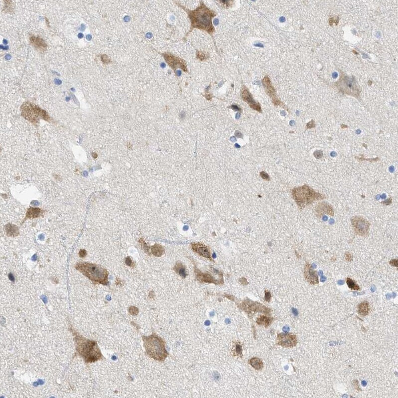 Tubby Antibody - BSA Free Immunohistochemistry-Paraffin: Tubby Antibody [NBP1-87824]