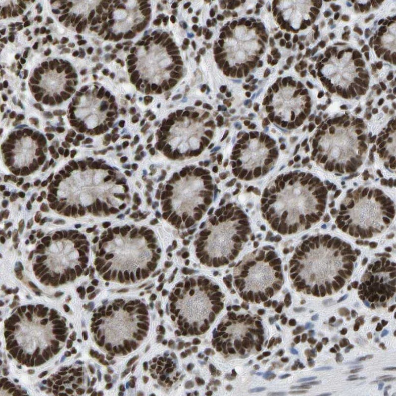 ZNF31 Antibody - BSA Free Immunohistochemistry-Paraffin: ZNF31 Antibody [NBP1-87830]