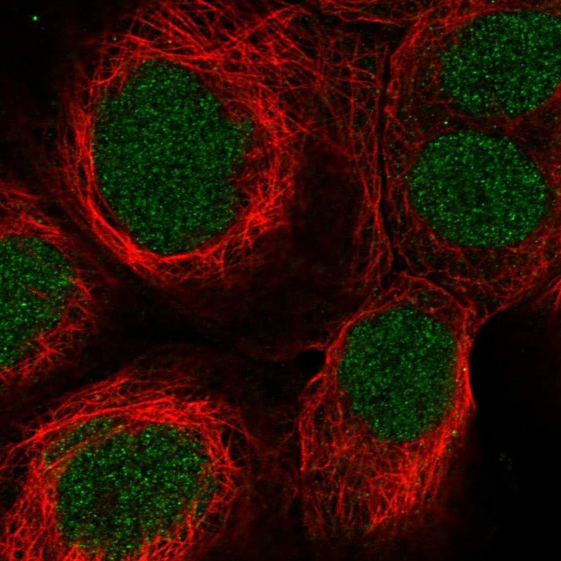 SynGAP Antibody - BSA Free Immunocytochemistry/ Immunofluorescence: SynGAP Antibody - BSA Free [NBP1-87841]