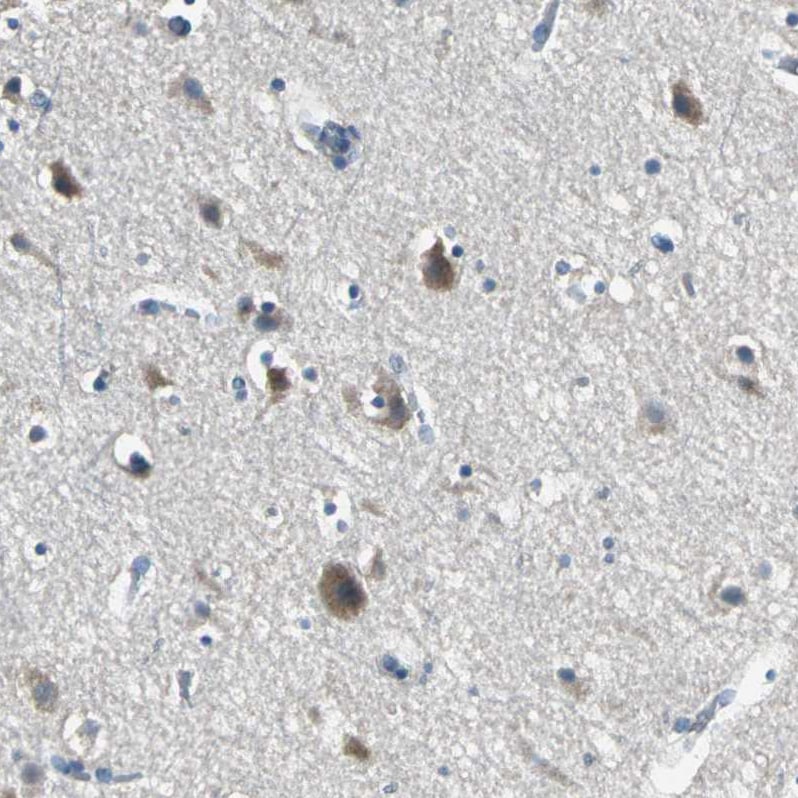MCT2 Antibody - BSA Free Immunohistochemistry-Paraffin: MCT2 Antibody - BSA Free [NBP1-87846]