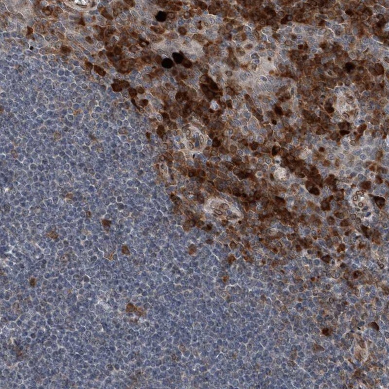 ICB1 Antibody - BSA Free Immunohistochemistry-Paraffin: ICB1 Antibody [NBP1-87848]