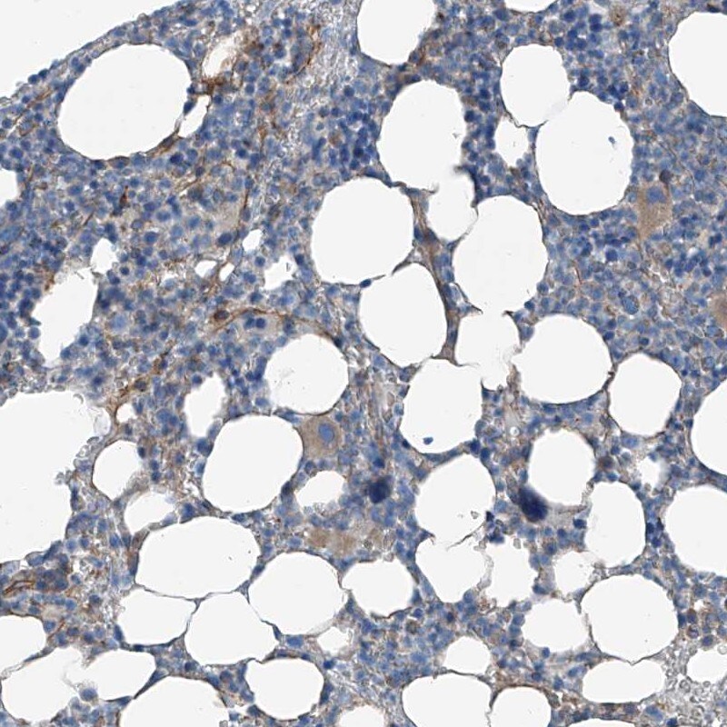 ICB1 Antibody - BSA Free Immunohistochemistry-Paraffin: ICB1 Antibody [NBP1-87849]
