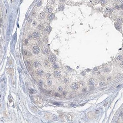 Myotilin Antibody - BSA Free Immunohistochemistry-Paraffin: Myotilin Antibody [NBP1-87851]