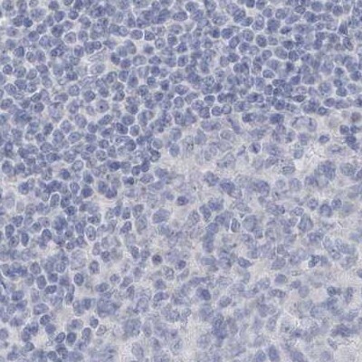 Myotilin Antibody - BSA Free Immunohistochemistry-Paraffin: Myotilin Antibody [NBP1-87851]
