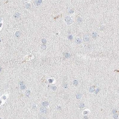 Myotilin Antibody - BSA Free Immunohistochemistry-Paraffin: Myotilin Antibody [NBP1-87851]