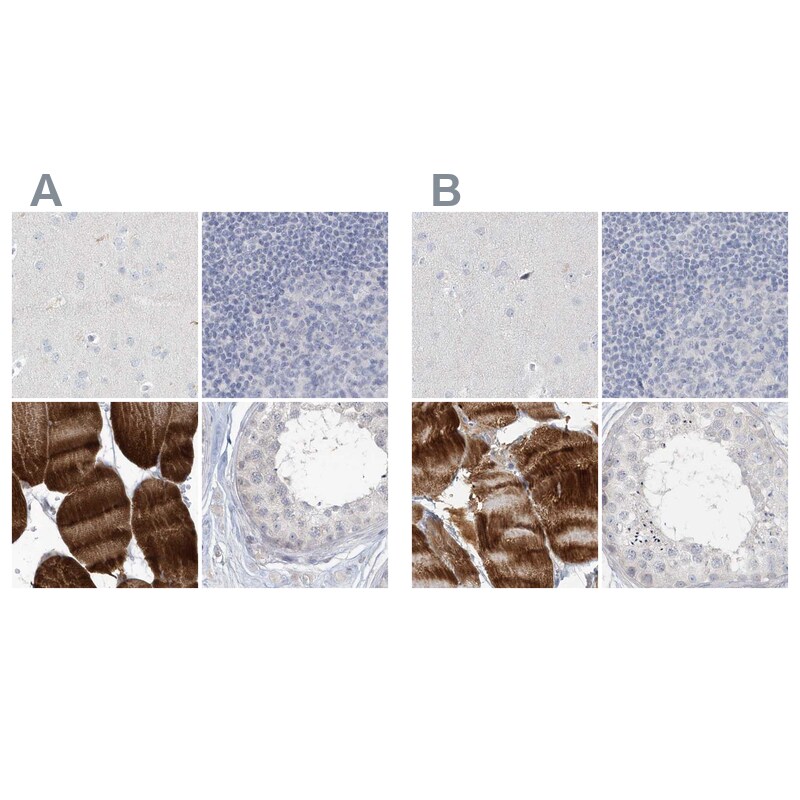 Myotilin Antibody - BSA Free Immunohistochemistry-Paraffin: Myotilin Antibody [NBP1-87851]
