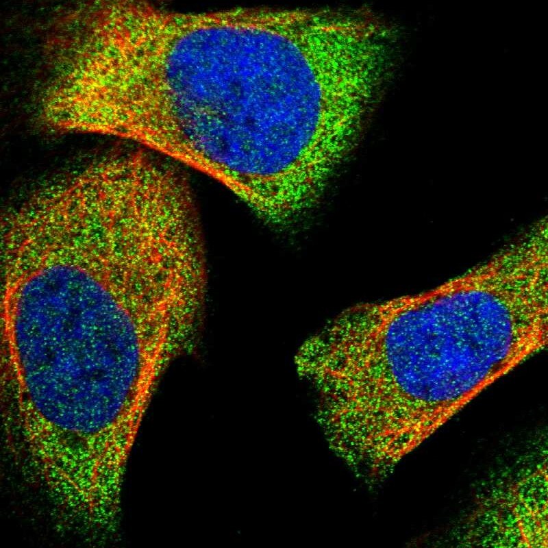 Lipin 2 Antibody - BSA Free Immunocytochemistry/ Immunofluorescence: Lipin 2 Antibody [NBP1-87853]