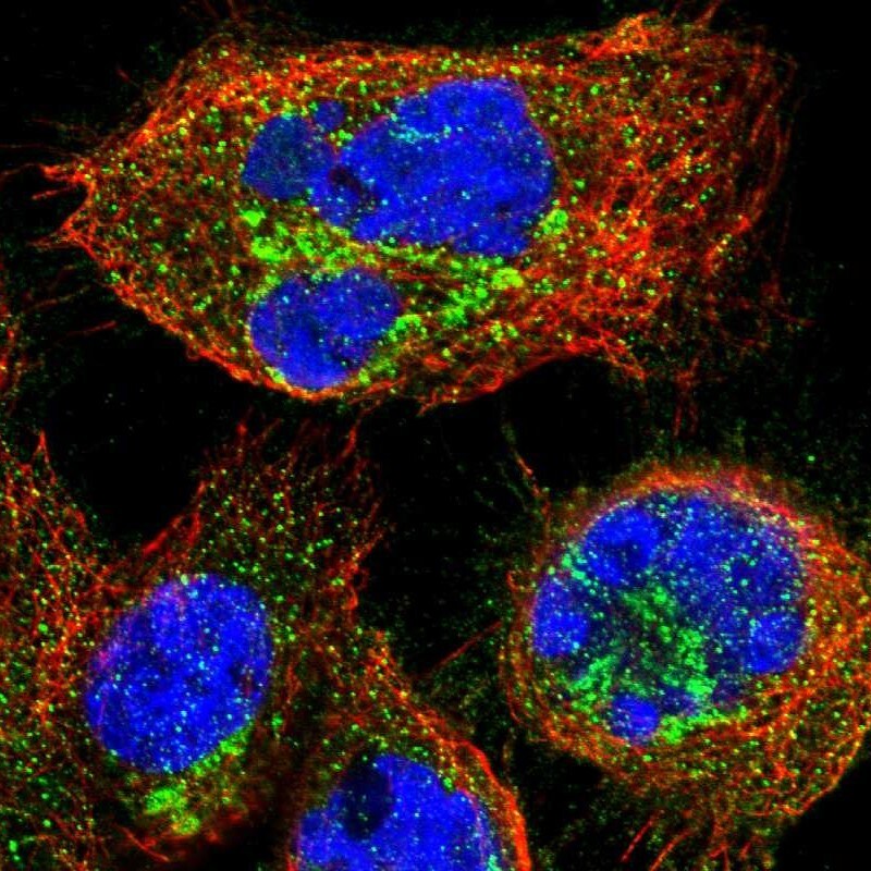 LKAP Antibody - BSA Free Immunocytochemistry/ Immunofluorescence: LKAP Antibody [NBP1-87854]