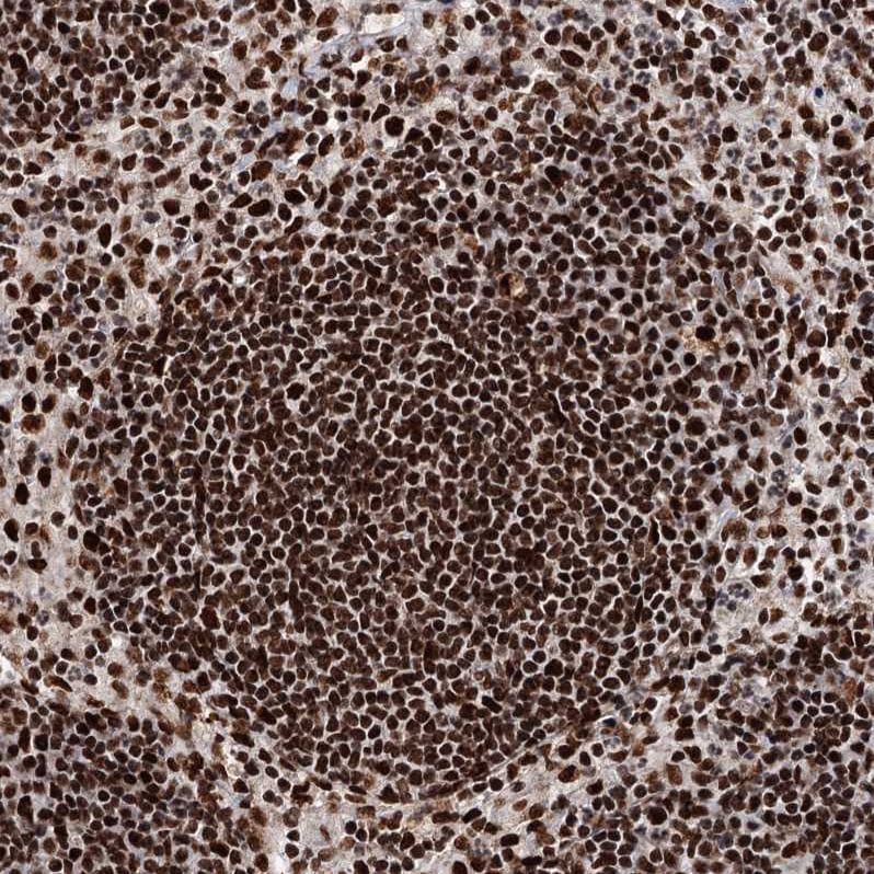 Matrin 3 Antibody - BSA Free Immunohistochemistry-Paraffin: Matrin 3 Antibody - BSA Free [NBP1-87860]