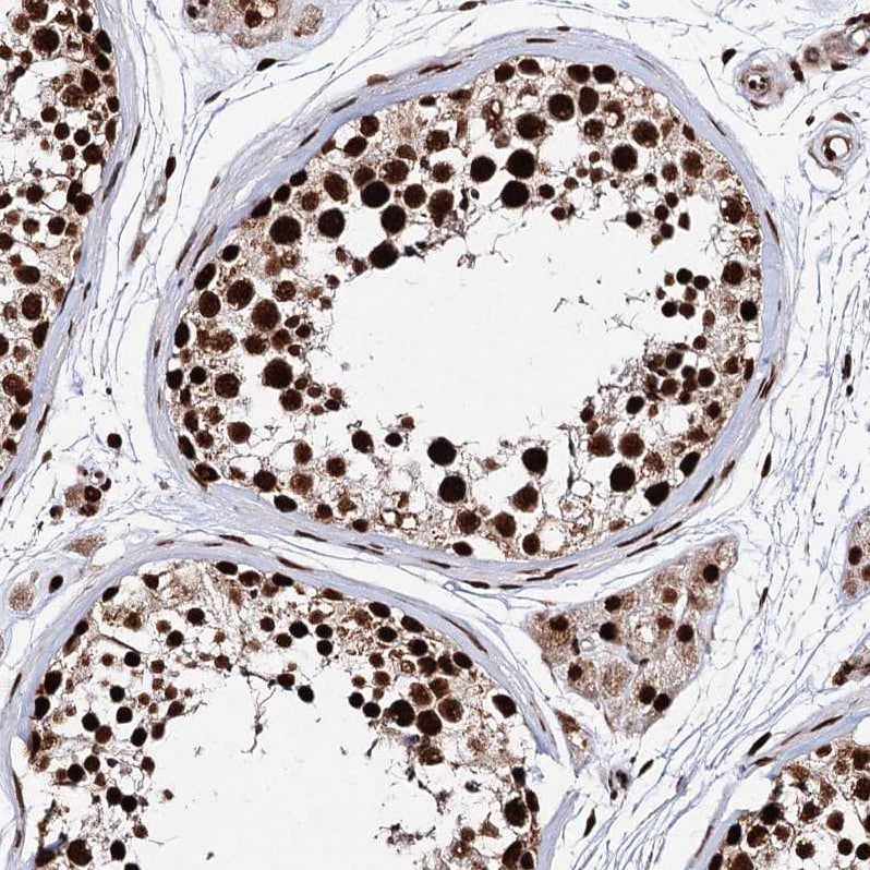 Matrin 3 Antibody - BSA Free Immunohistochemistry-Paraffin: Matrin 3 Antibody - BSA Free [NBP1-87860]
