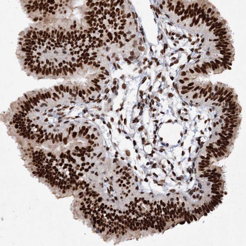 Matrin 3 Antibody - BSA Free Immunohistochemistry-Paraffin: Matrin 3 Antibody - BSA Free [NBP1-87860]