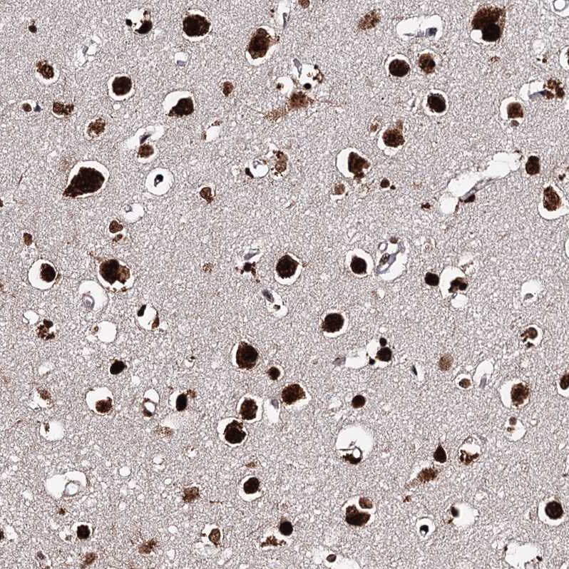 Matrin 3 Antibody - BSA Free Immunohistochemistry-Paraffin: Matrin 3 Antibody - BSA Free [NBP1-87860]