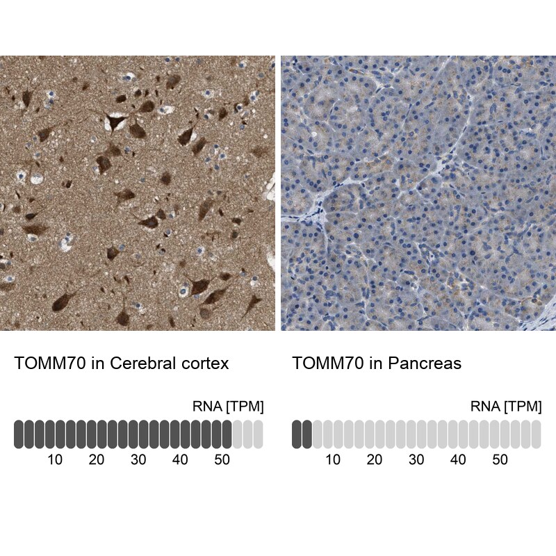 TOM70 Antibody - BSA Free Immunohistochemistry-Paraffin: TOM70 Antibody - BSA Free [NBP1-87863]