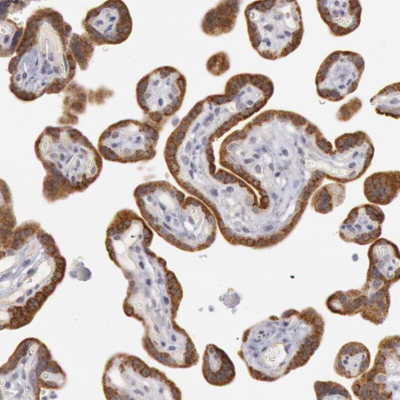 Josephin1 Antibody - BSA Free Immunohistochemistry-Paraffin: Josephin1 Antibody - BSA Free [NBP1-87864]
