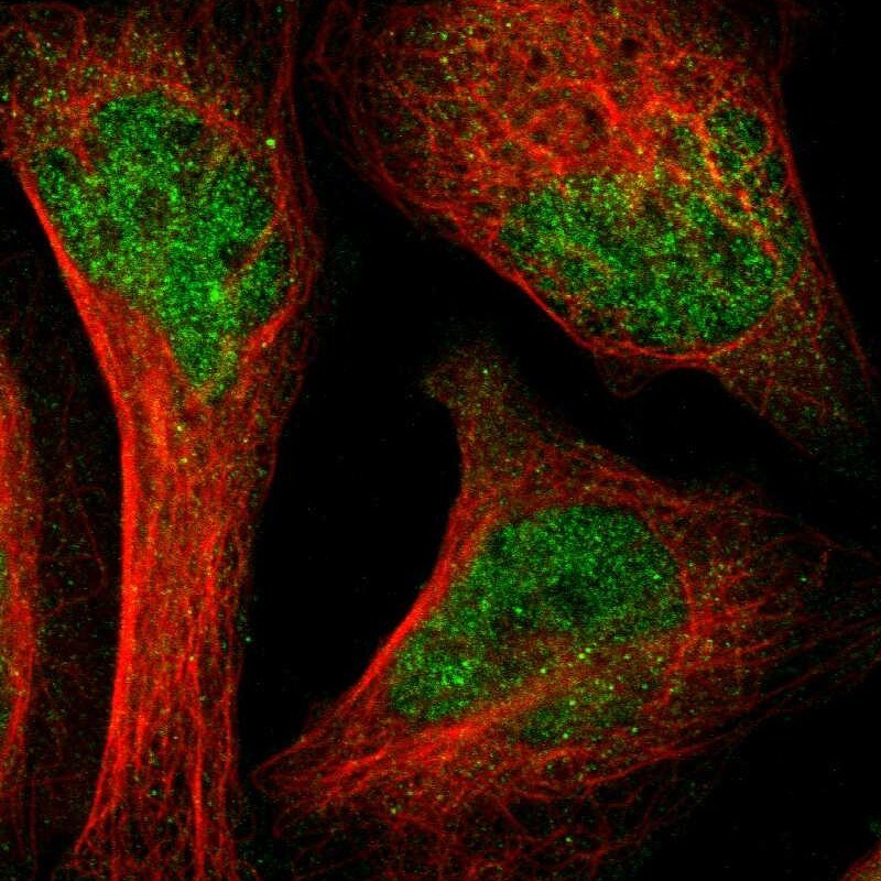 LNK/SH2B3 Antibody - BSA Free Immunocytochemistry/ Immunofluorescence: LNK/SH2B3 Antibody [NBP1-87867]