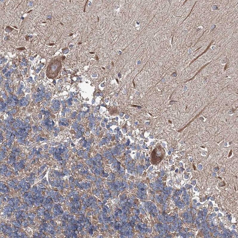 MPHOSPH9- Antibody - BSA Free Immunohistochemistry: MPHOSPH9- Antibody - BSA Free [NBP1-87870]