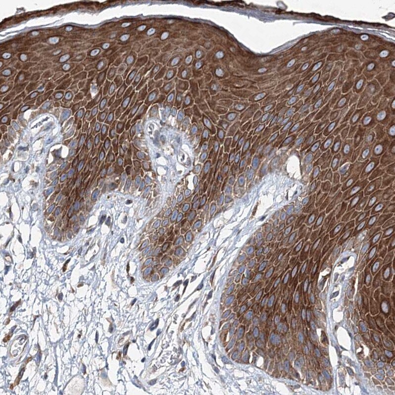 MPHOSPH9- Antibody - BSA Free Immunohistochemistry: MPHOSPH9- Antibody - BSA Free [NBP1-87870]