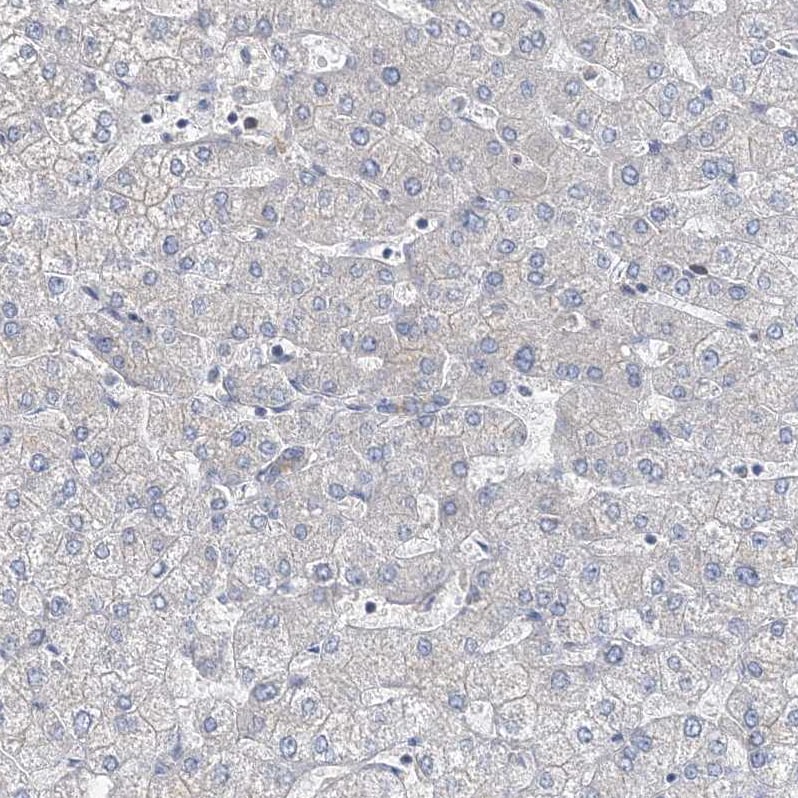 MPHOSPH9- Antibody - BSA Free Immunohistochemistry: MPHOSPH9- Antibody - BSA Free [NBP1-87870]
