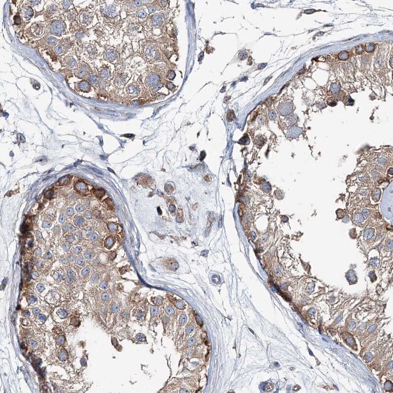 MPHOSPH9- Antibody - BSA Free Immunohistochemistry: MPHOSPH9- Antibody - BSA Free [NBP1-87870]
