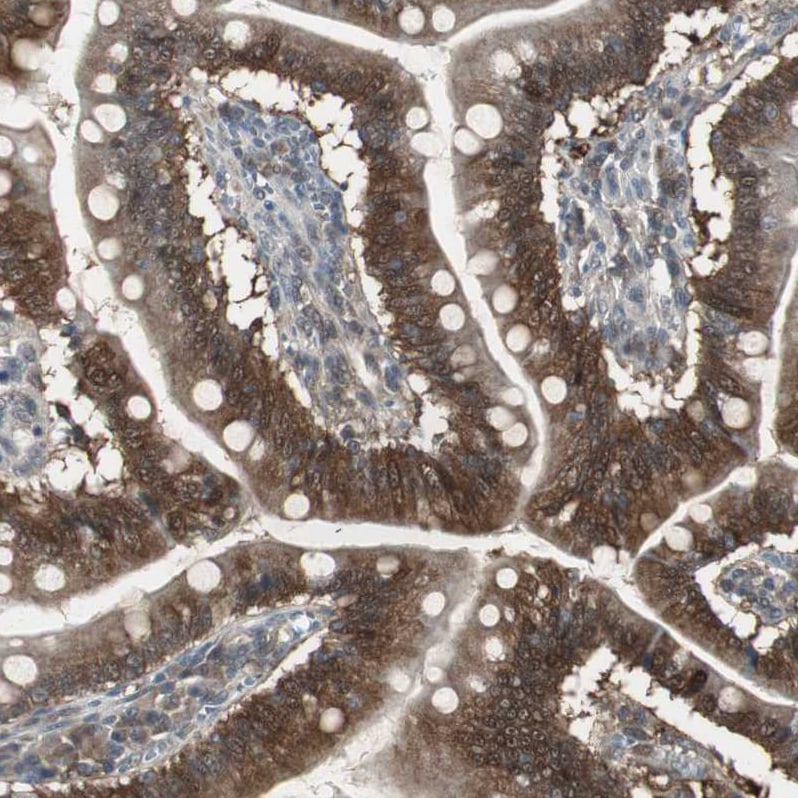 Perilipin-3/TIP47 Antibody - BSA Free Immunohistochemistry-Paraffin: Perilipin-3/TIP47 Antibody [NBP1-87871]