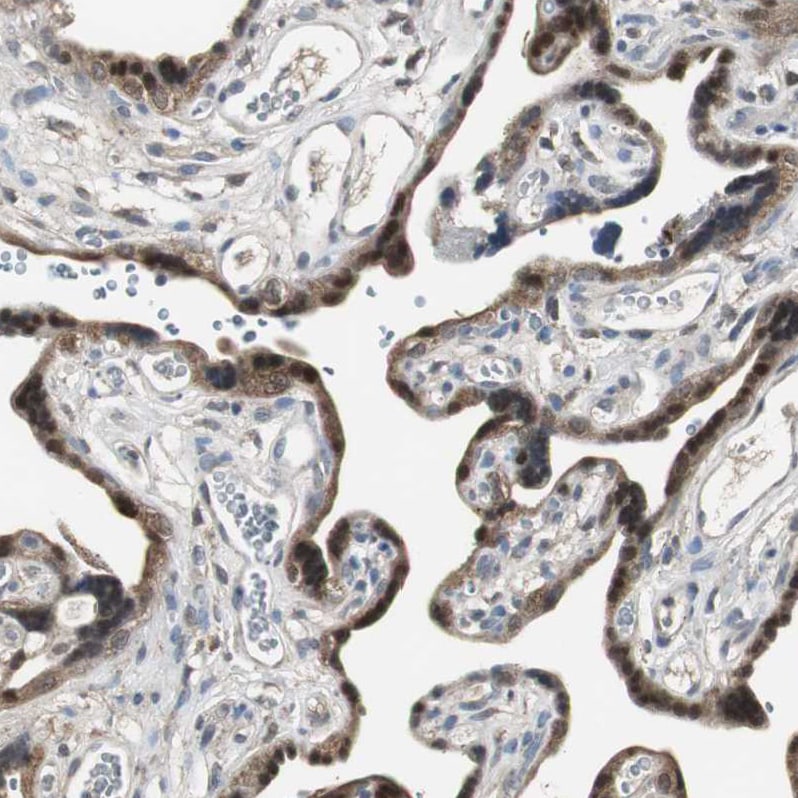 Perilipin-3/TIP47 Antibody - BSA Free Immunohistochemistry-Paraffin: Perilipin-3/TIP47 Antibody [NBP1-87871]