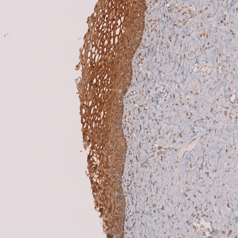 Perilipin-3/TIP47 Antibody - BSA Free Immunohistochemistry-Paraffin: Perilipin-3/TIP47 Antibody [NBP1-87871]
